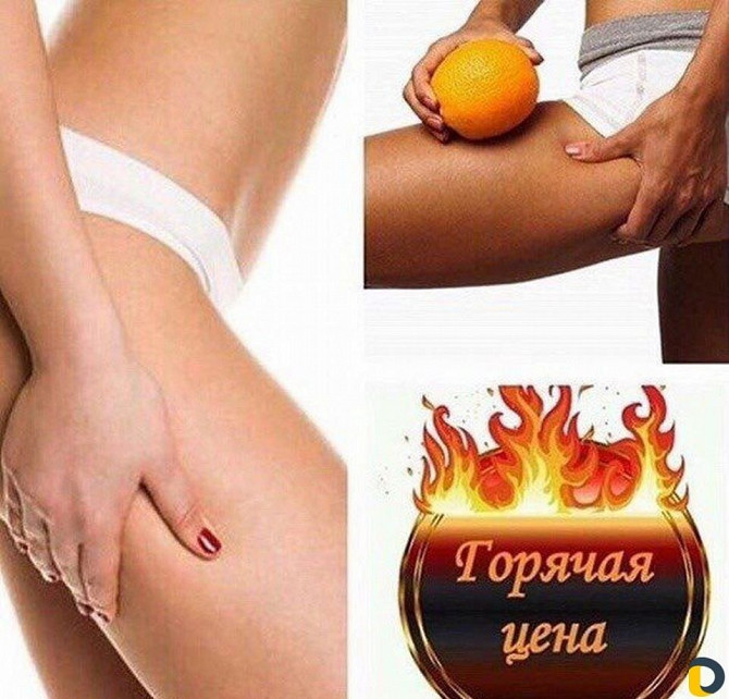 Коррекция фигуры Київ - зображення 1
