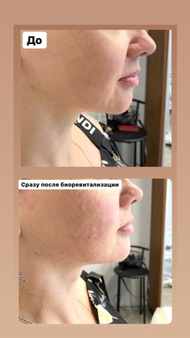 Косметолог, м. Полтава Полтава - изображение 4