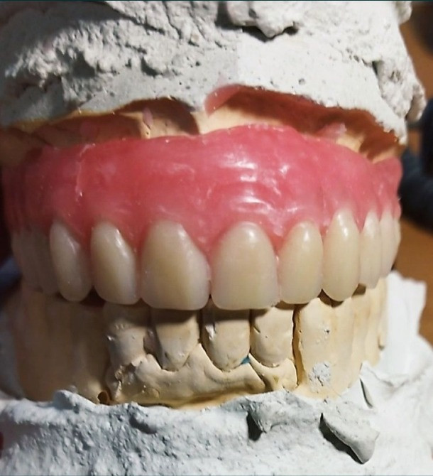 Зуботехнічна лабораторія, зубний технік Попільня - зображення 4