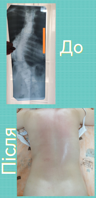 Лікувальний масаж Луцк - изображение 4