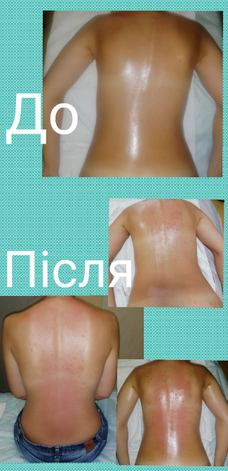 Лікувальний масаж Луцк - изображение 3