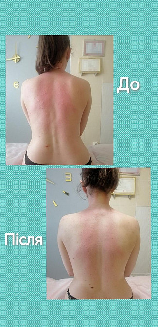 Лікувальний масаж Луцк - изображение 2