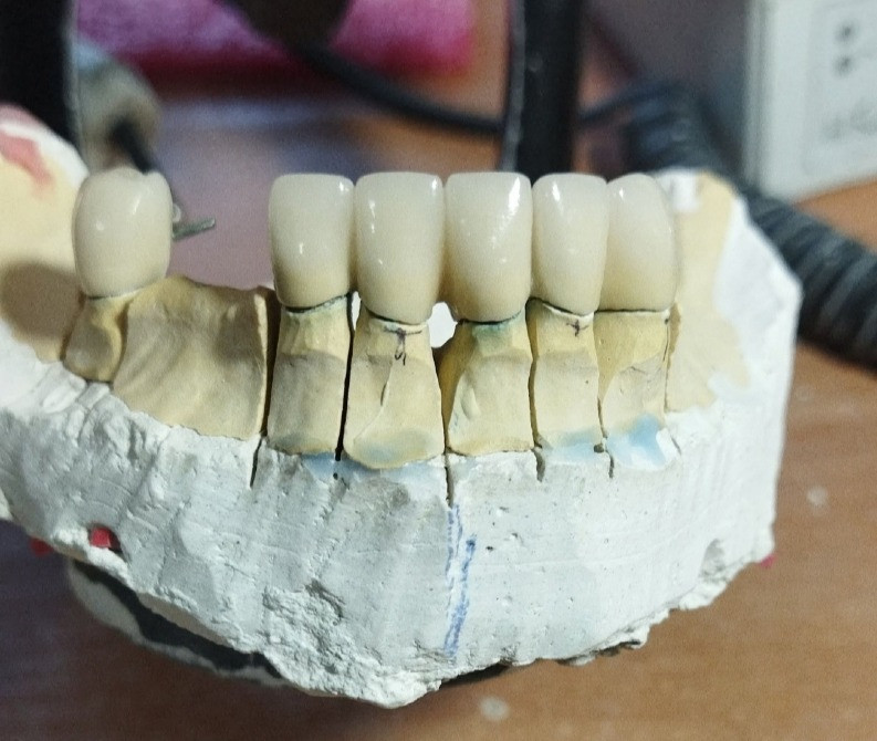 Зуботехнічна лабораторія, зубний технік Попільня - зображення 1