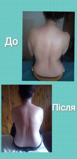 Лікувальний масаж Луцк - изображение 5