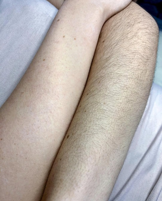 Депіляція віск/шугаринг Луцк - изображение 5