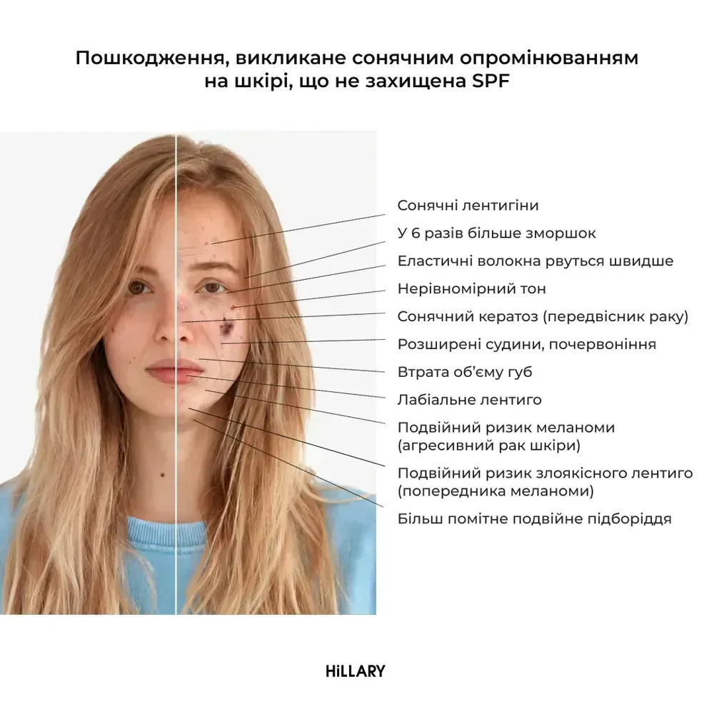 Сонцезахисна зволожуюча сироватка з вітаміном С Київ - зображення 4