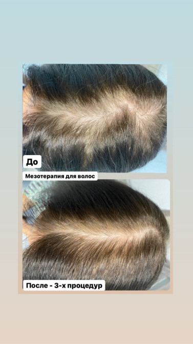 Косметолог, м. Полтава Полтава - изображение 3