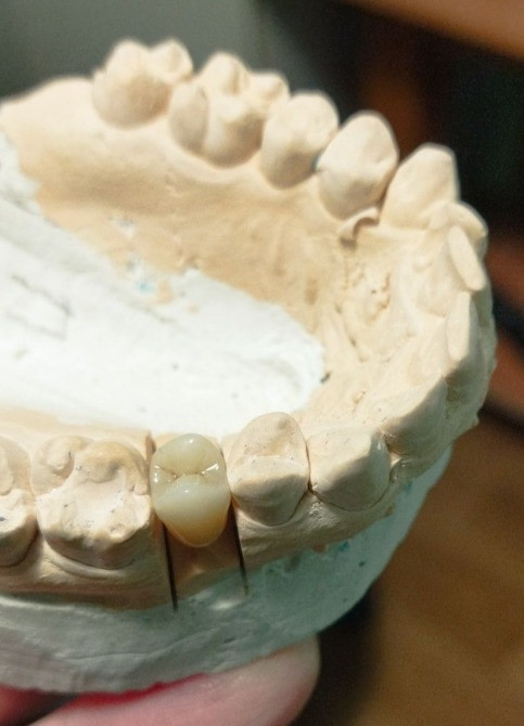 Зуботехнічна лабораторія, зубний технік Попільня - зображення 2